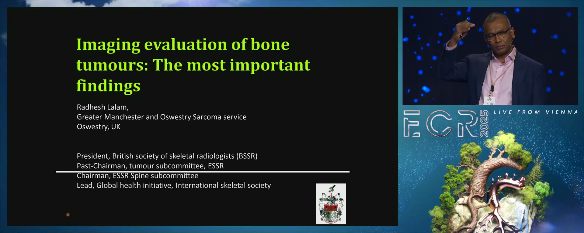 Bone tumours