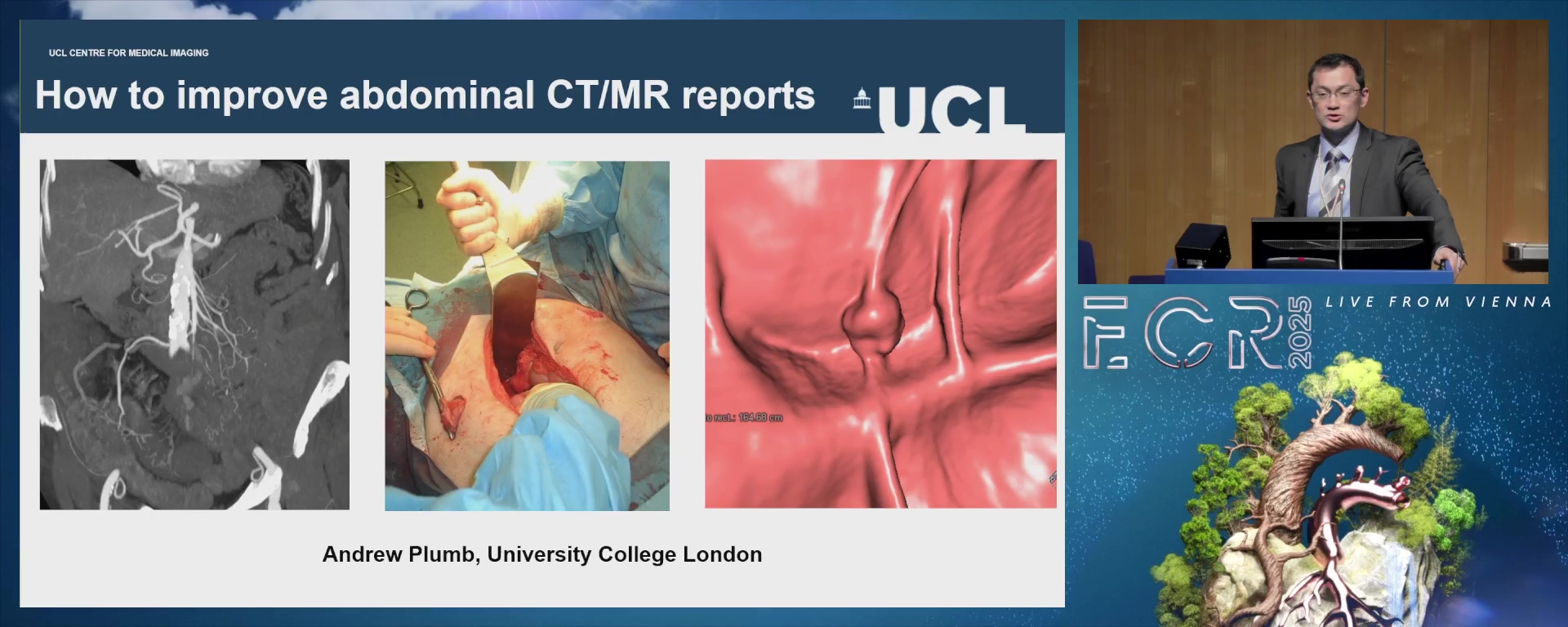 Tips on improving abdominal imaging reports