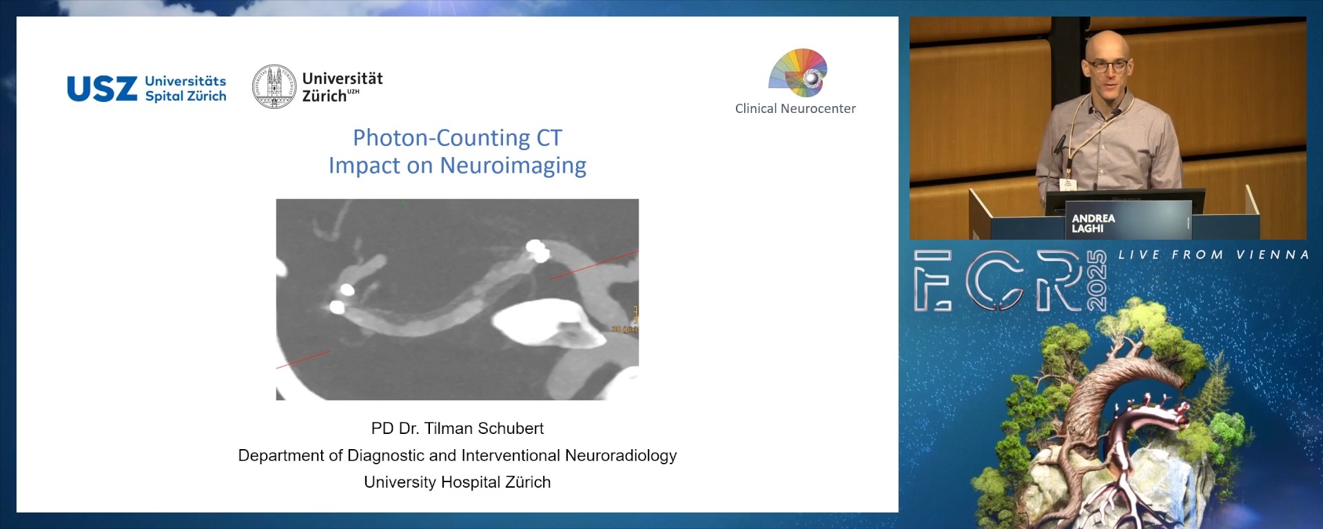 Impact on neuroimaging