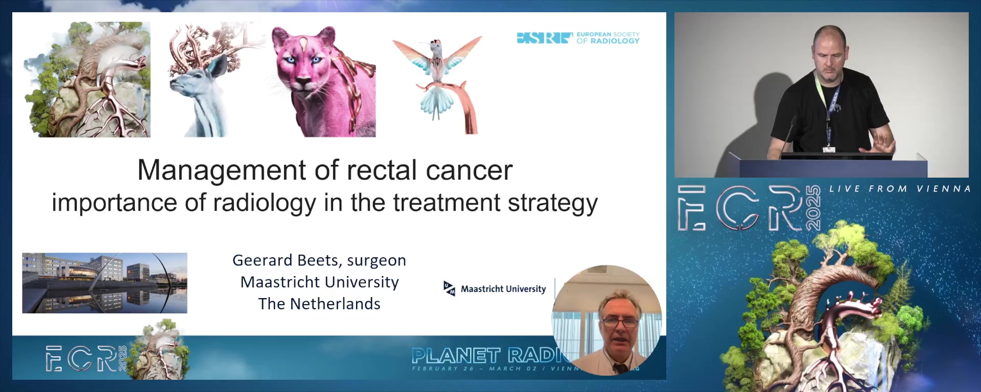 Management of rectal cancer: importance of radiological staging in the choice of treatment strategy