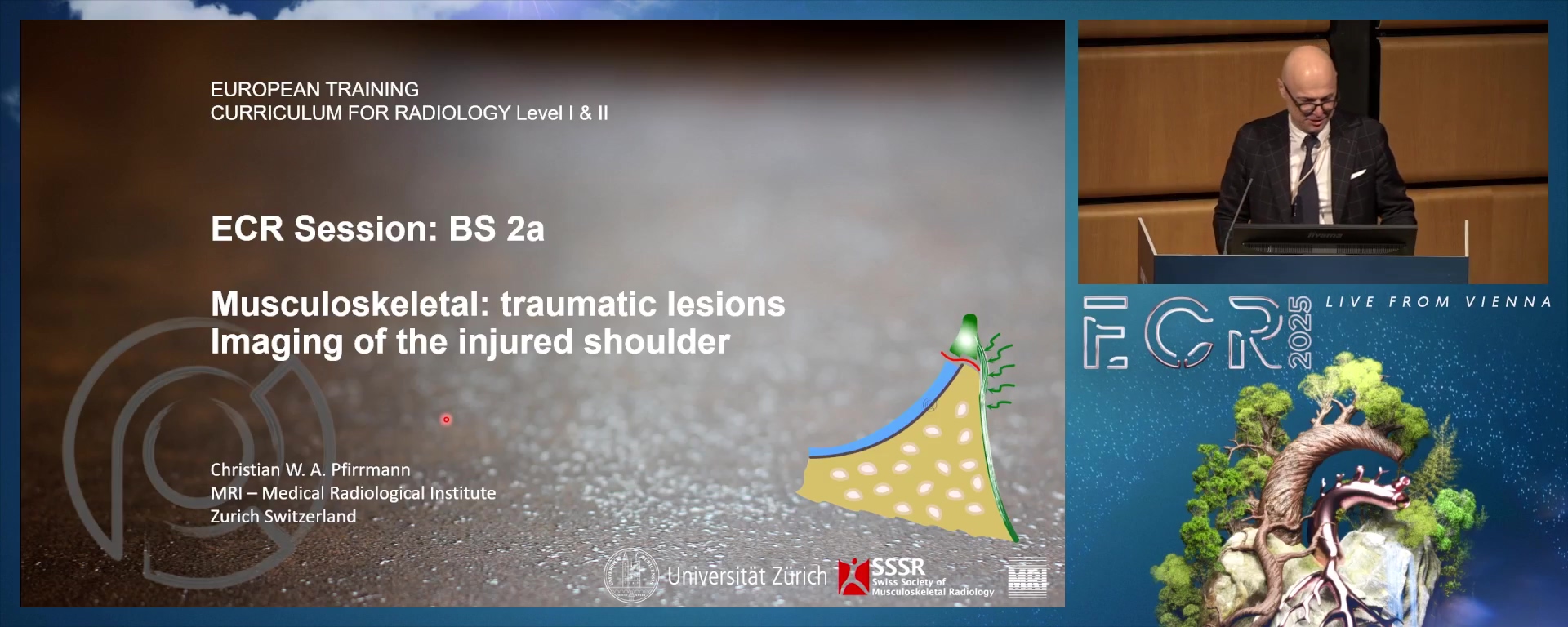 Imaging of the injured shoulder