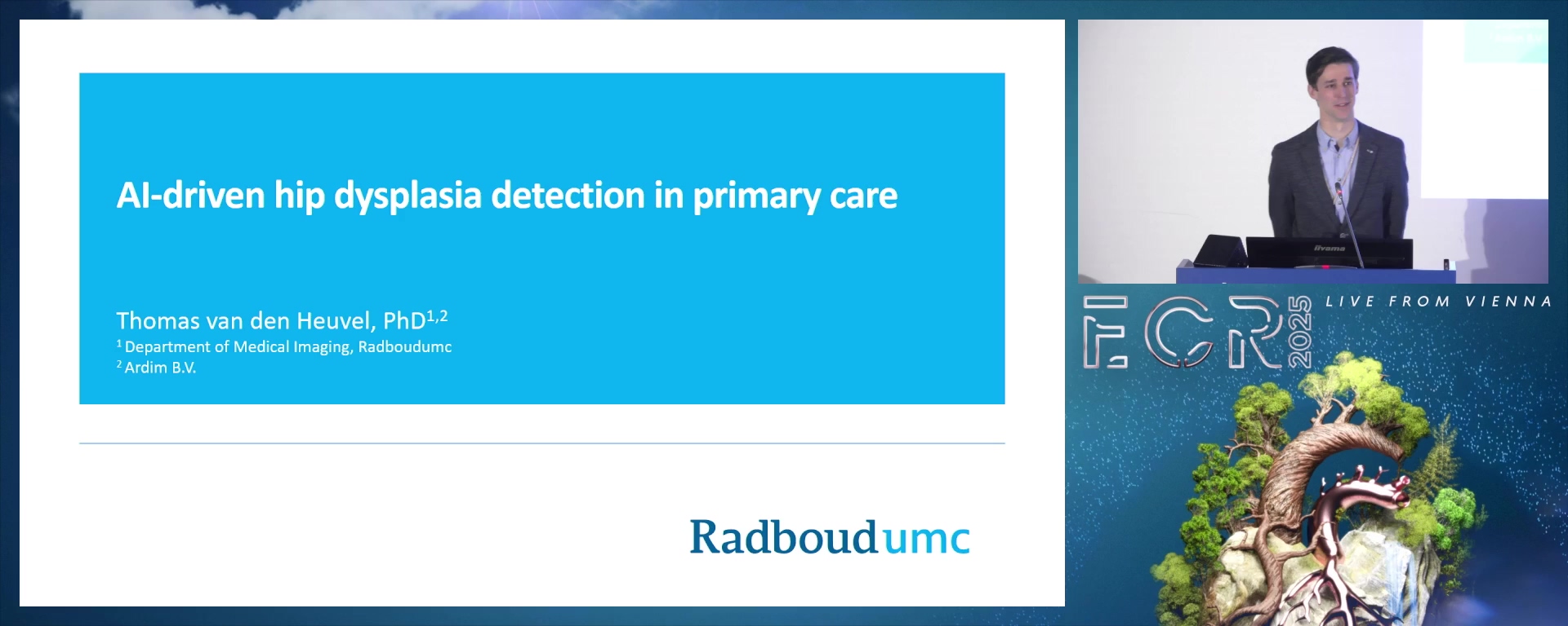 AI-driven hip dysplasia detection in primary care