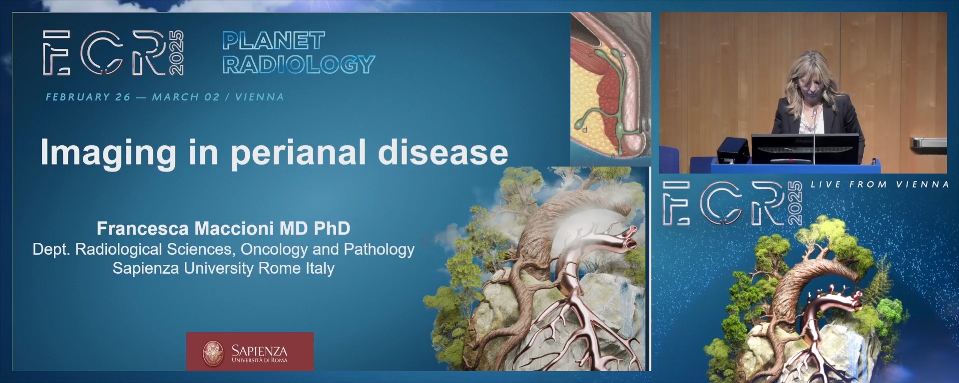 Imaging in perianal Crohn's disease