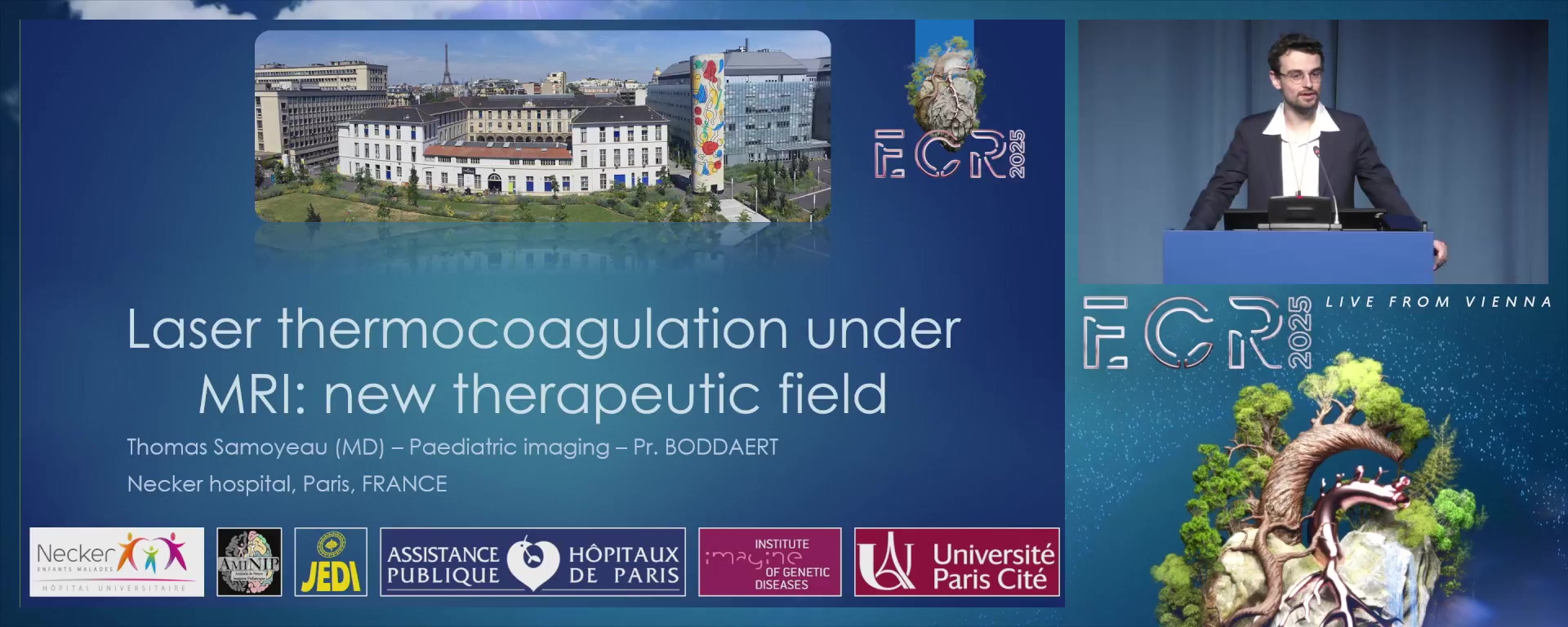 Laser thermocoagulation under MRI: new therapeutic field