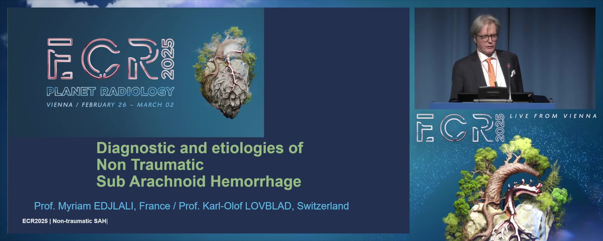 Imaging of intracranial haemorrhage