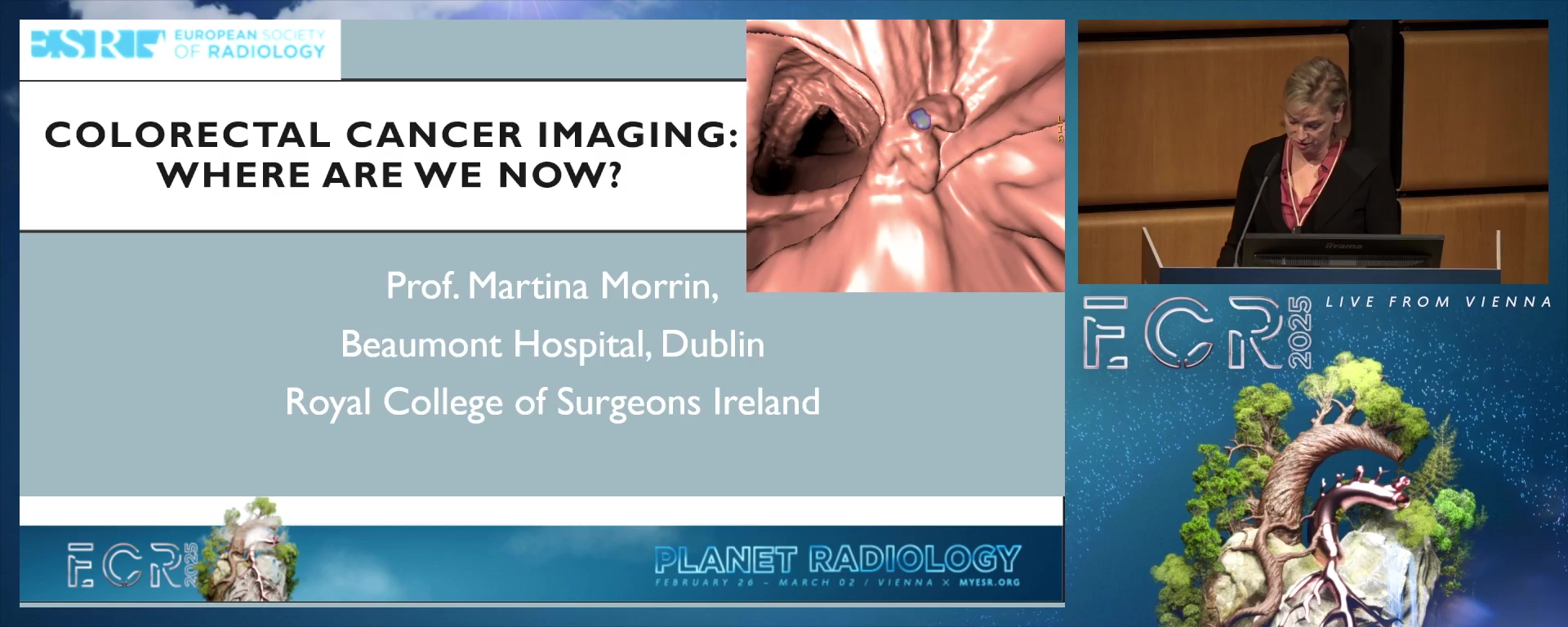 State of the Art colon cancer staging and future directions