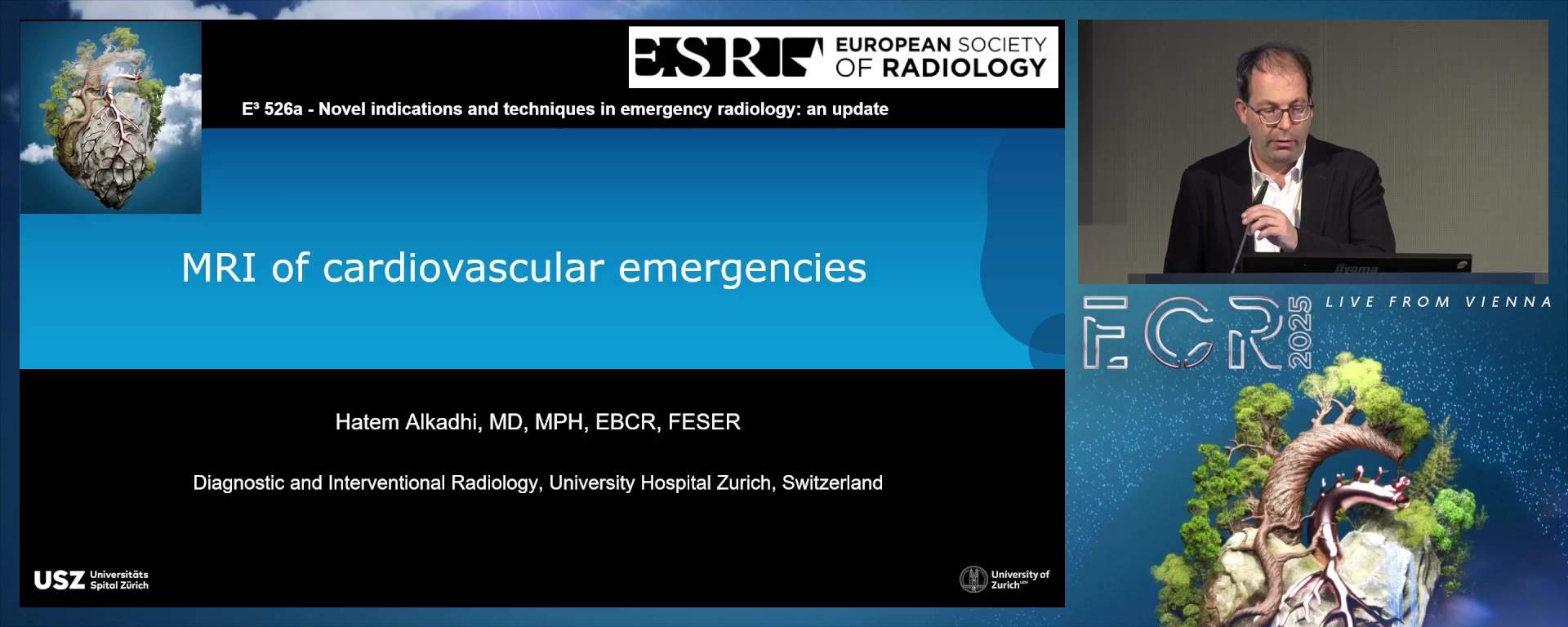 MRI of cardiovascular emergencies