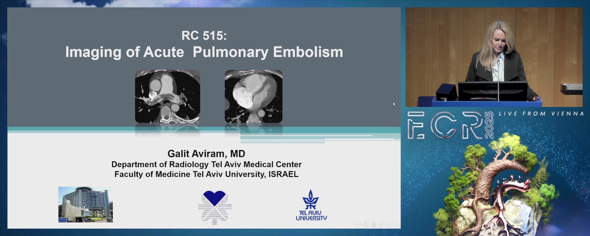 Pulmonary embolism (PE) imaging
