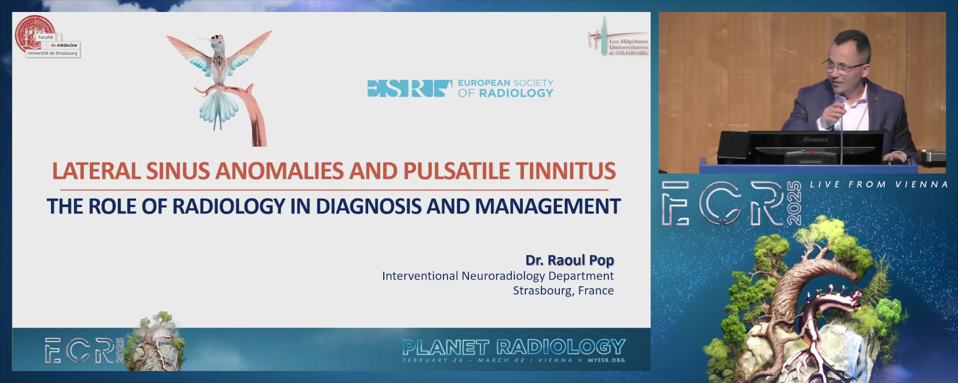 Lateral sinus anomalies and pulsatile tinnitus: the role of radiology in diagnosis and management