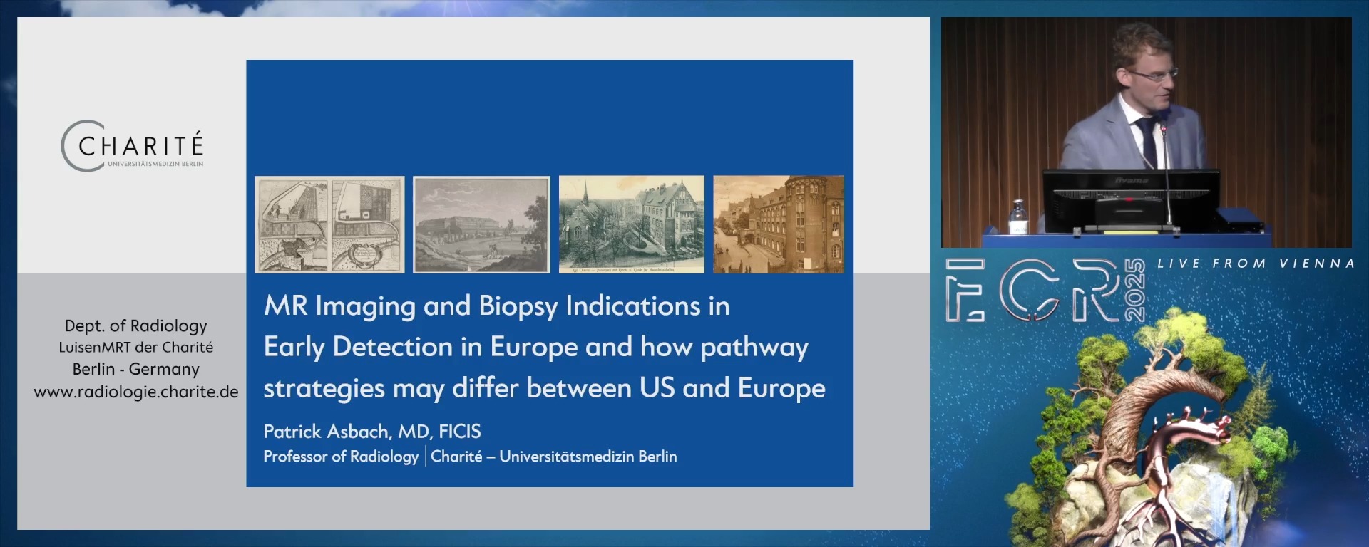 MR imaging and biopsy indications in early detection in Europe