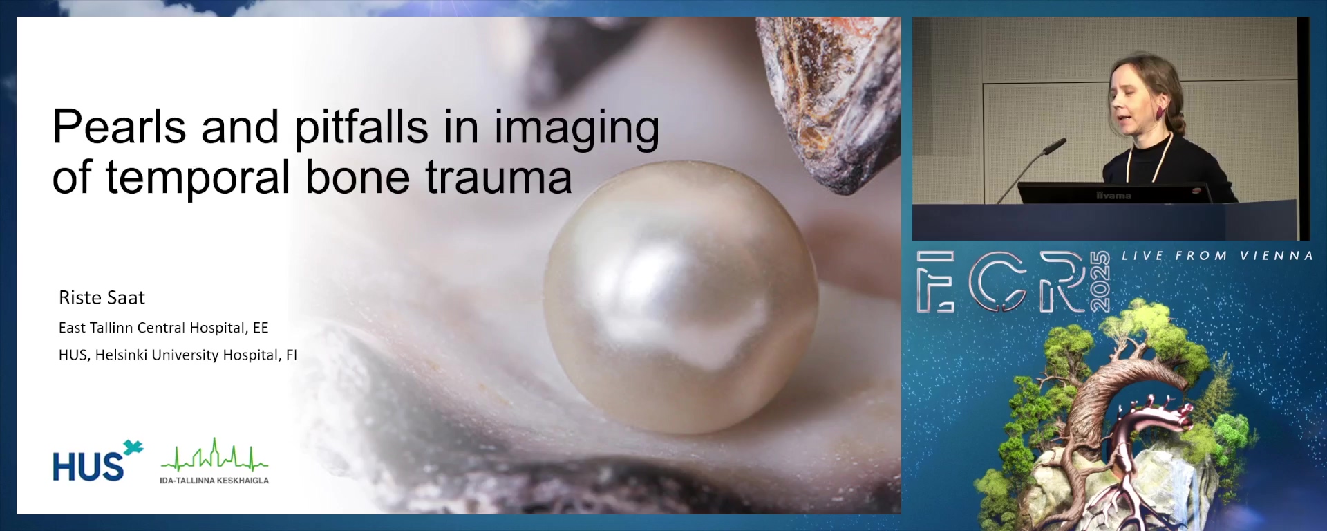 Pearls and pitfalls in imaging of temporal bone trauma