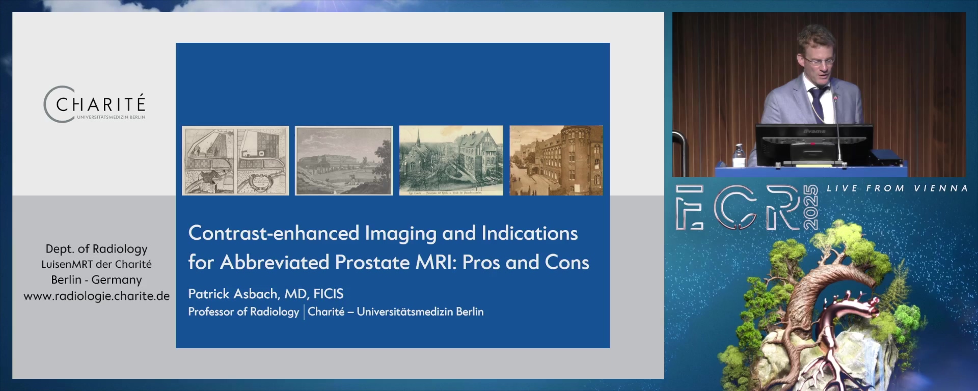 Contrast-enhanced imaging and indications for abbreviated prostate MRI: pros and cons