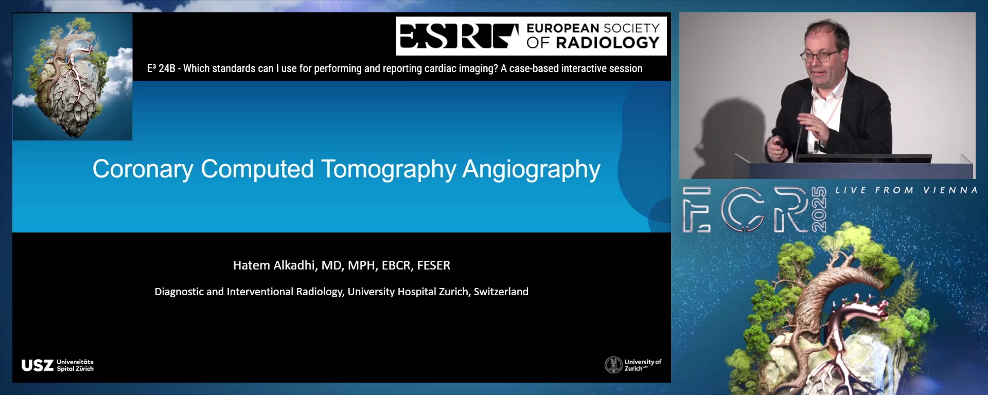 Coronary computed tomography angiography