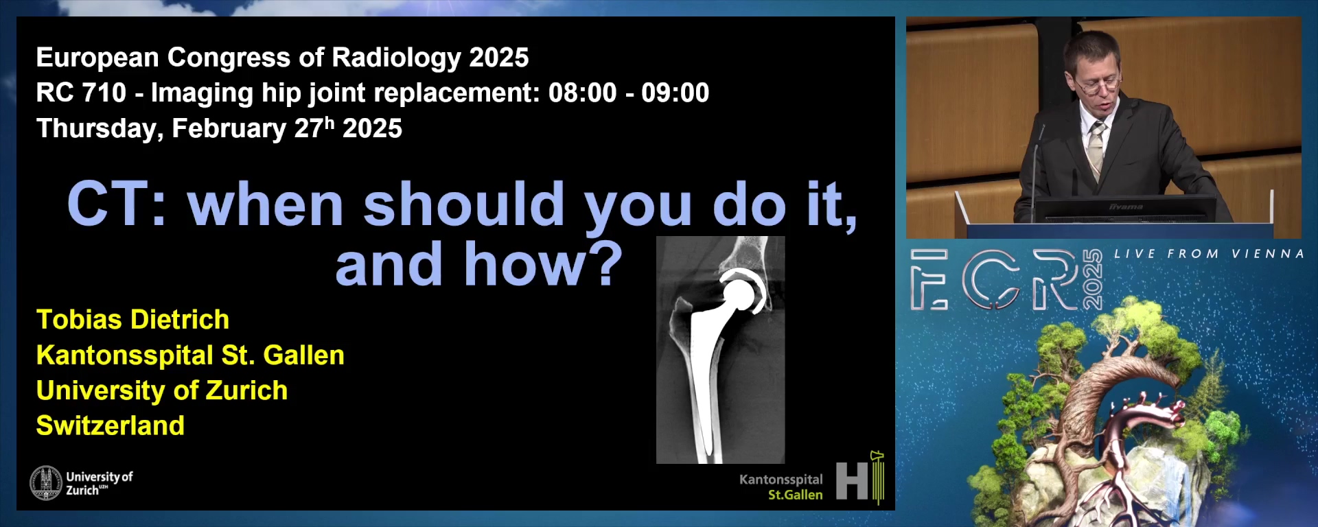 CT: when should you do it, and how?