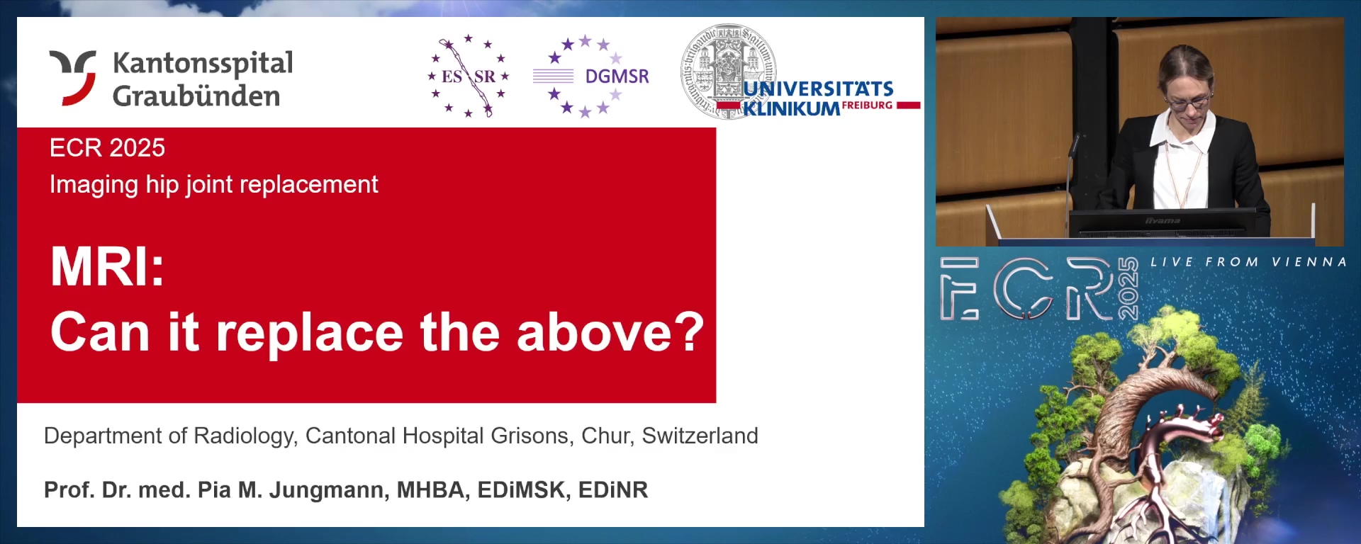 MRI: can it replace the above?