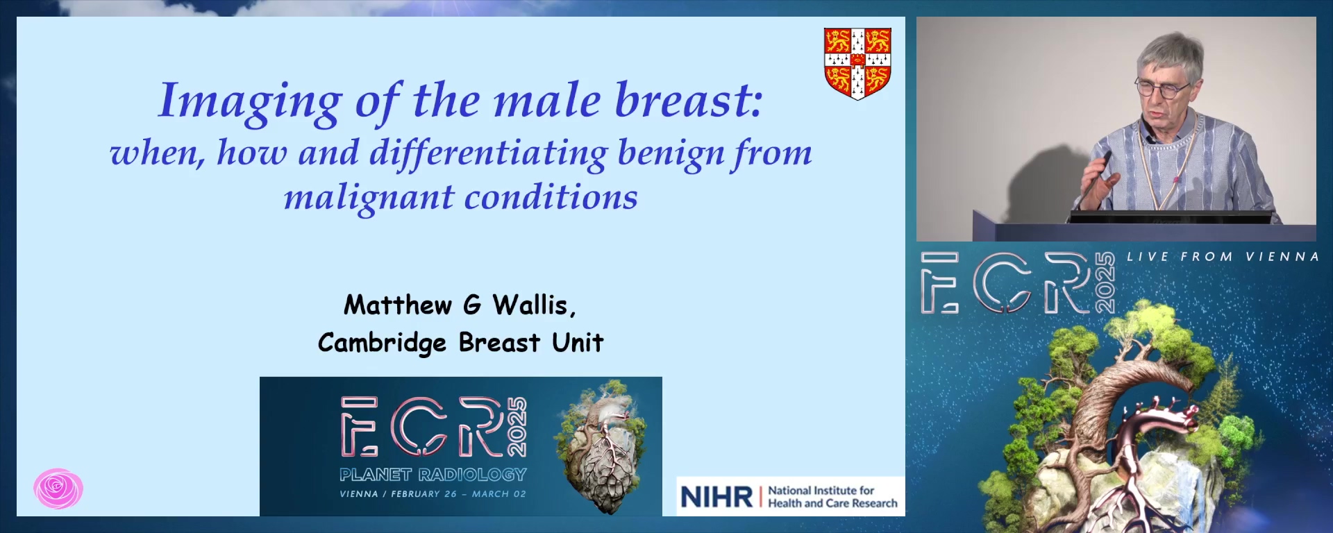 Imaging of the male breast: when, how and differentiating benign from malignant conditions