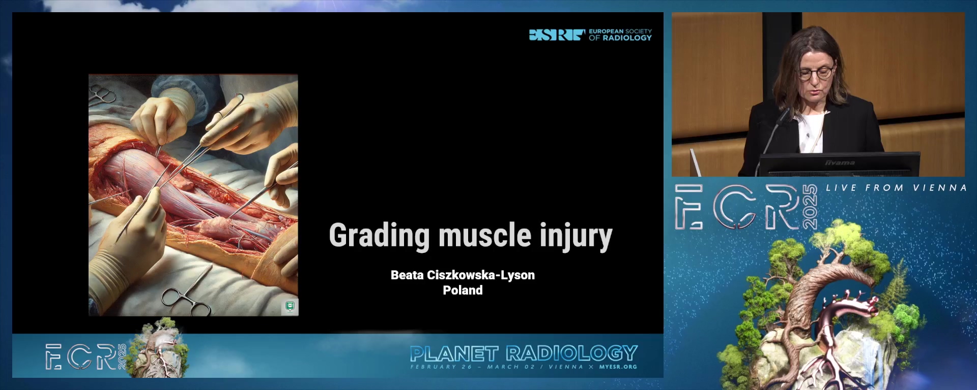 Grading muscle injury