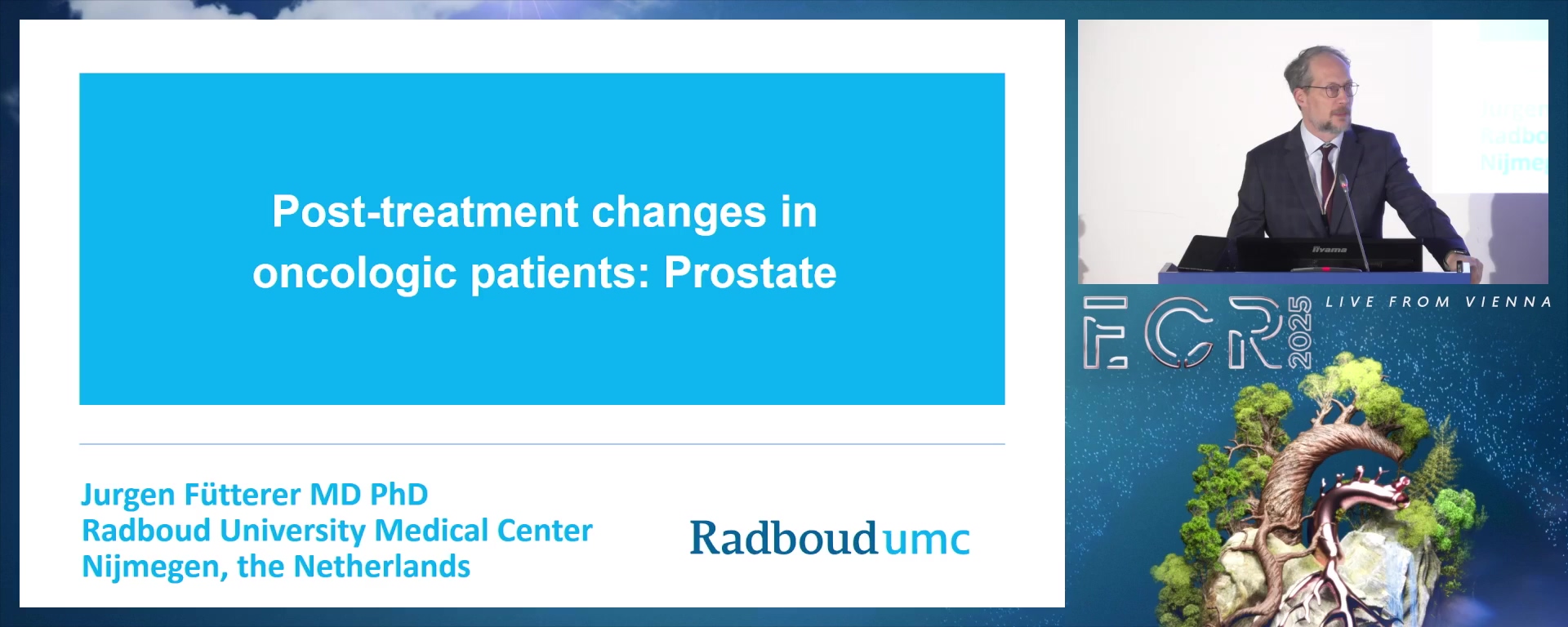 Prostate