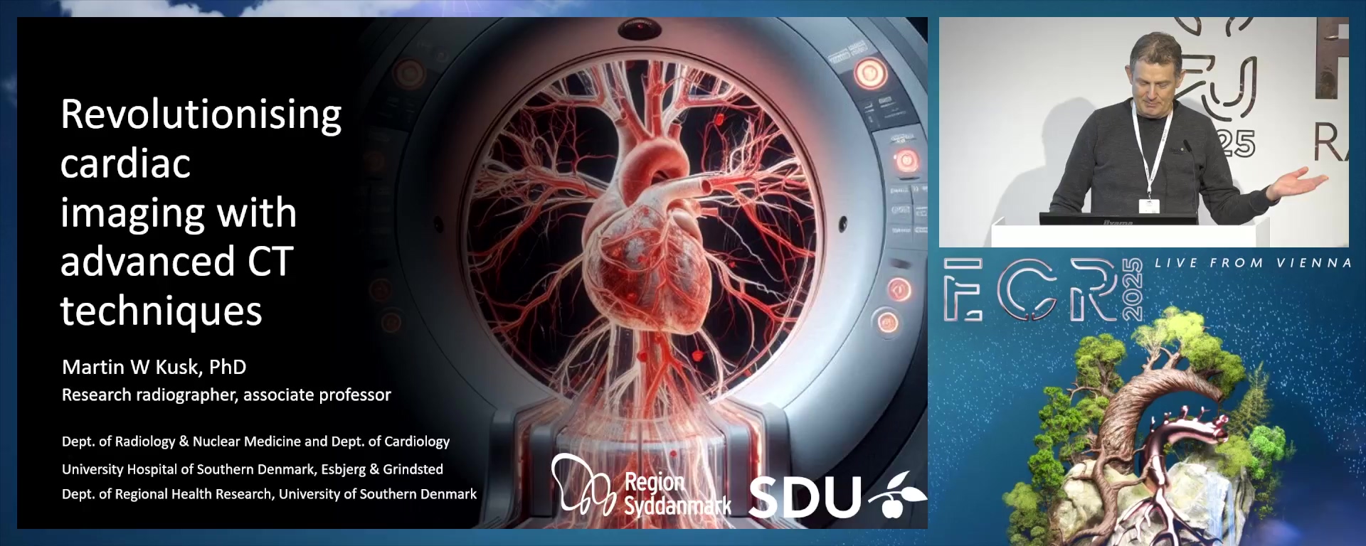 Revolutionising cardiac imaging with advanced CT techniques