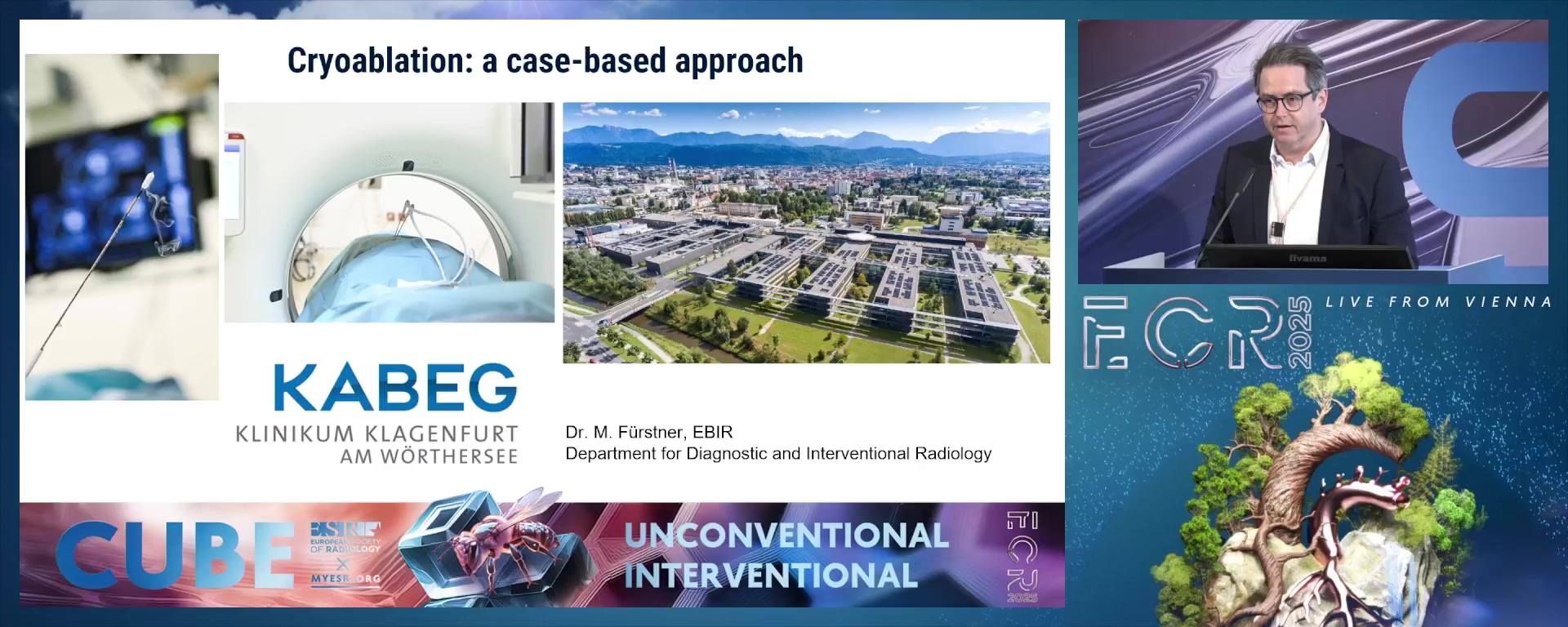Cryoablation: a case-based approach