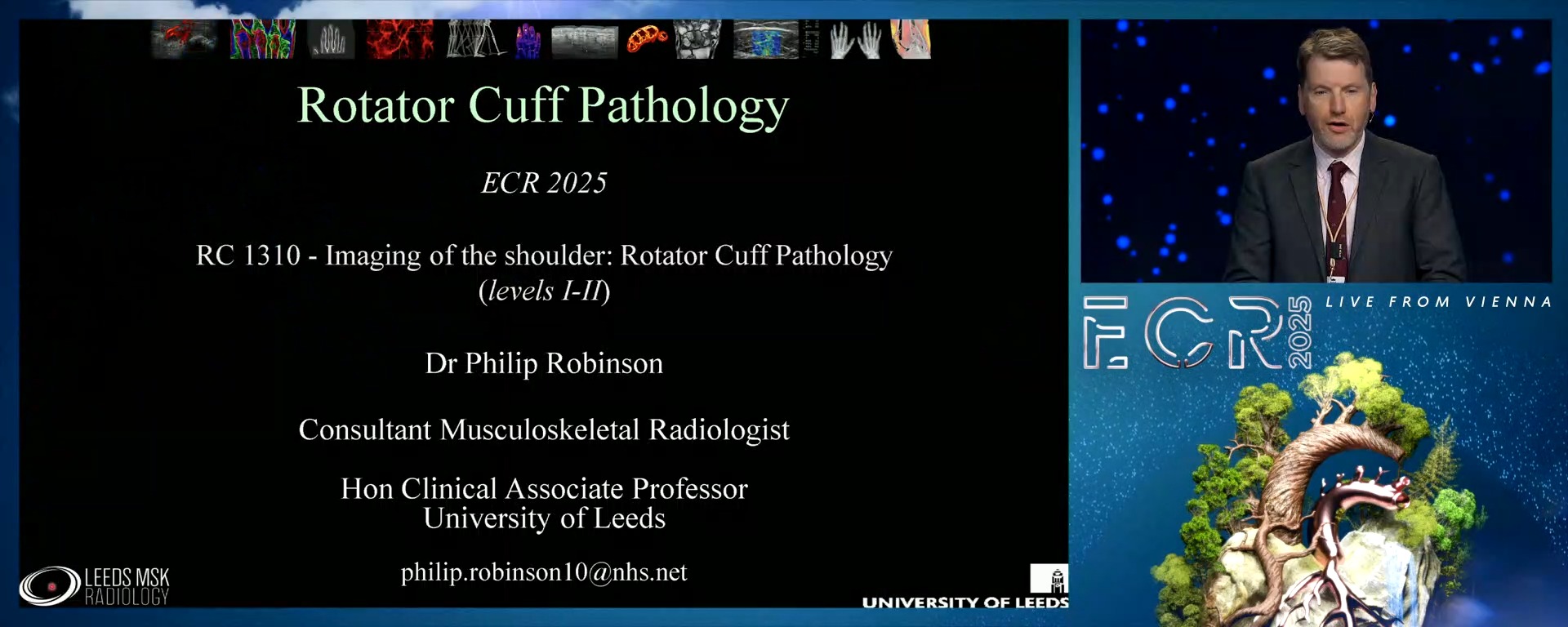 Rotator cuff pathology