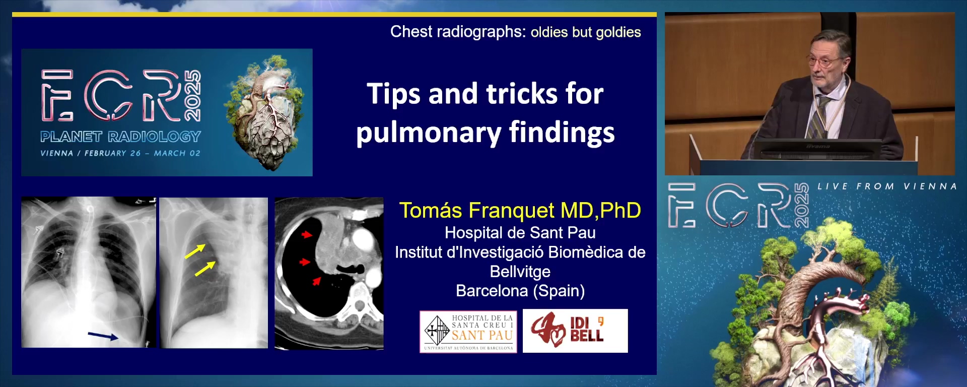 Tips and tricks for pulmonary findings