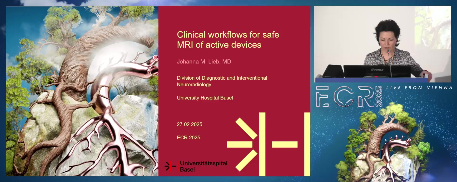 Clinical workflows for safe MRI of active devices