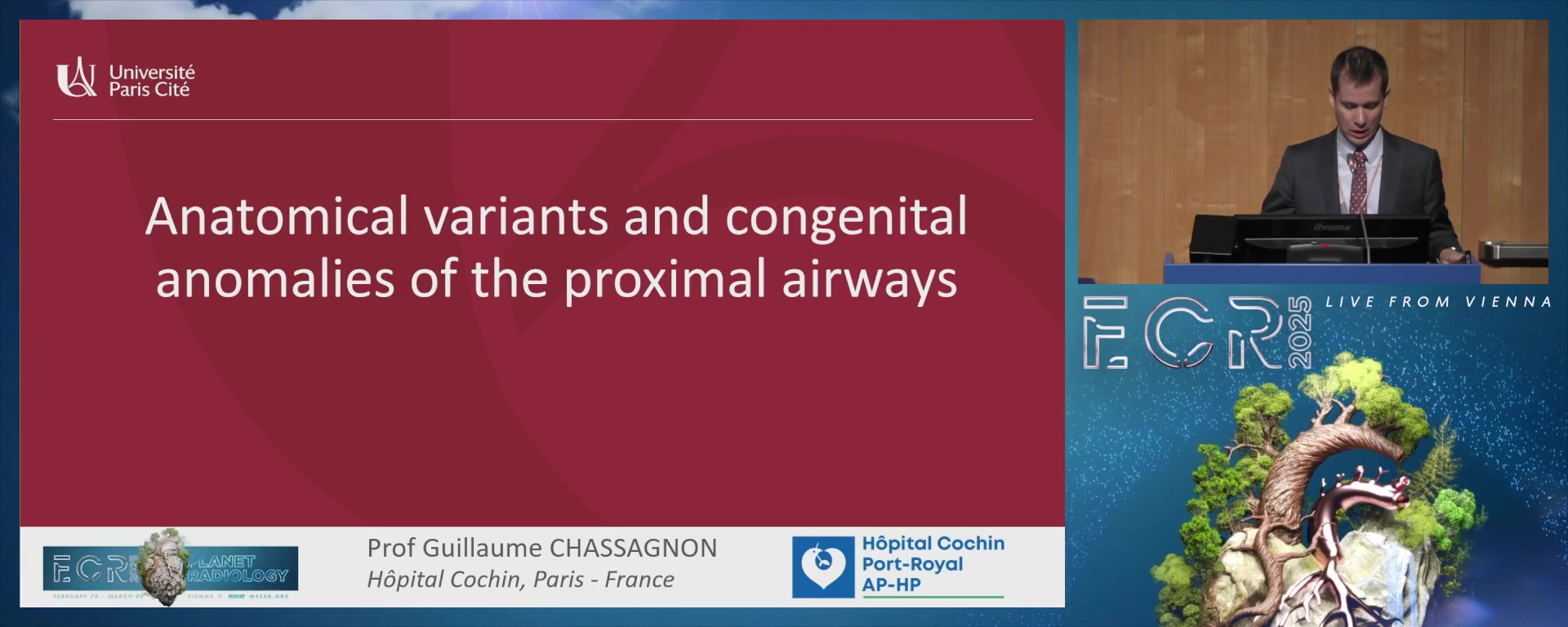 Anatomical variants and congenital anomalies of the proximal airways
