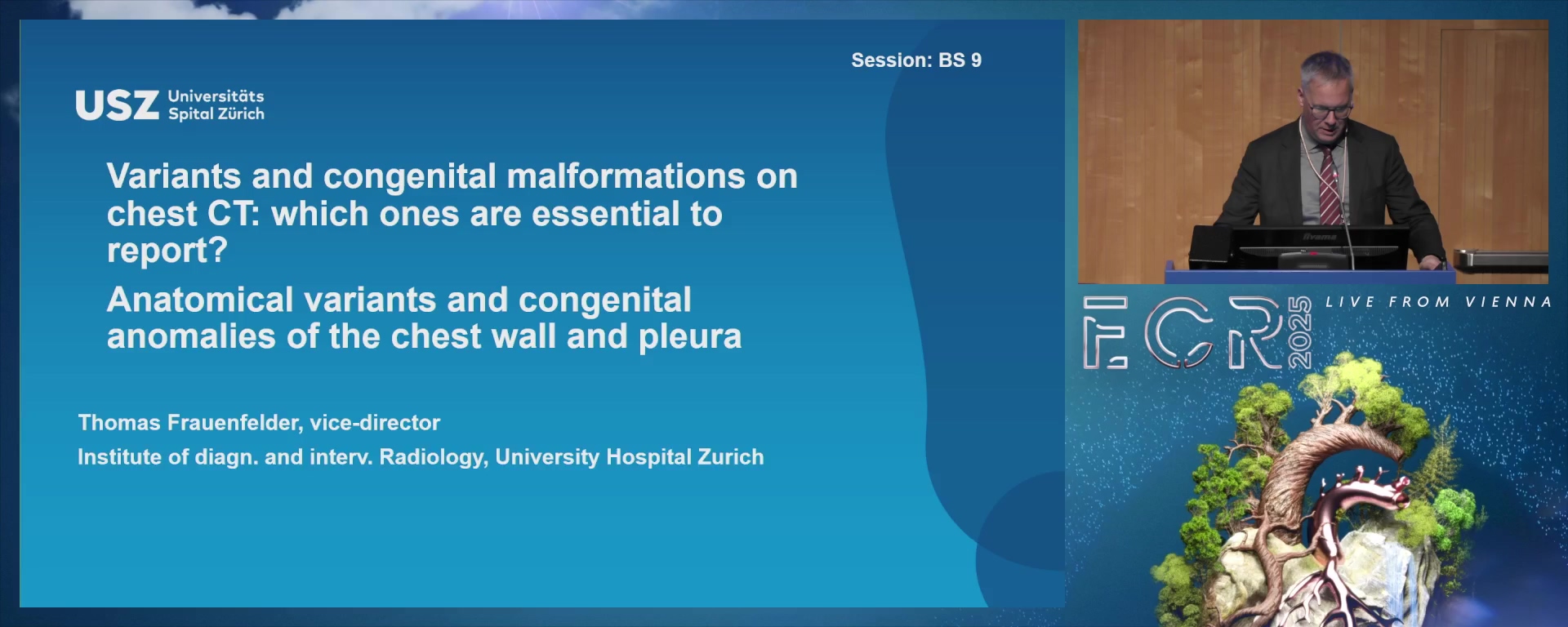 Anatomical variants and congenital anomalies of the chest wall and pleura