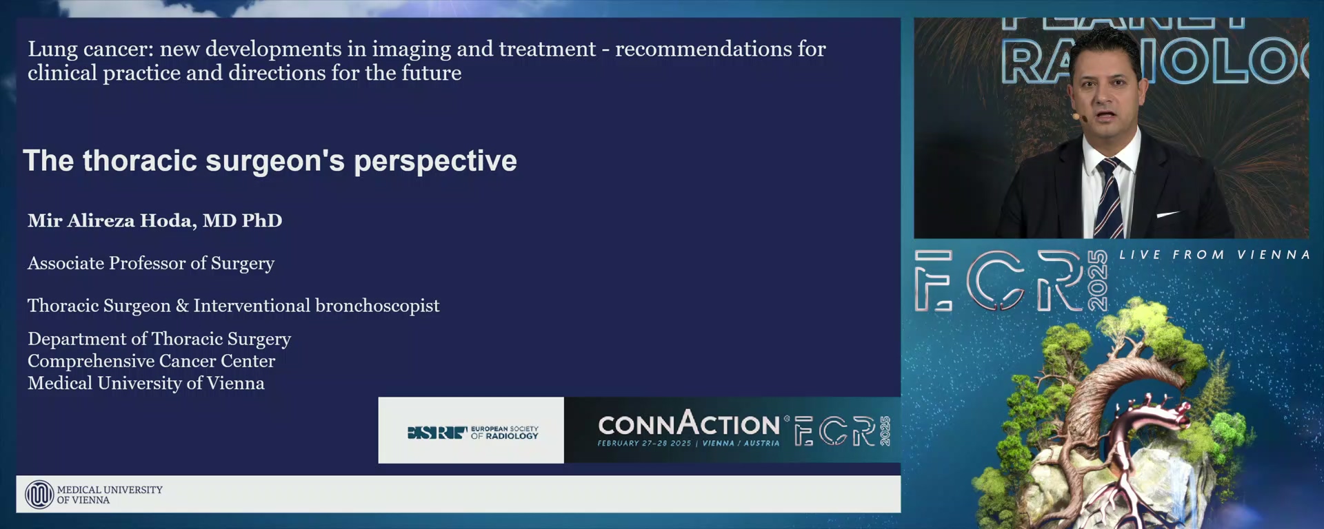 The thoracic surgeon's perspective