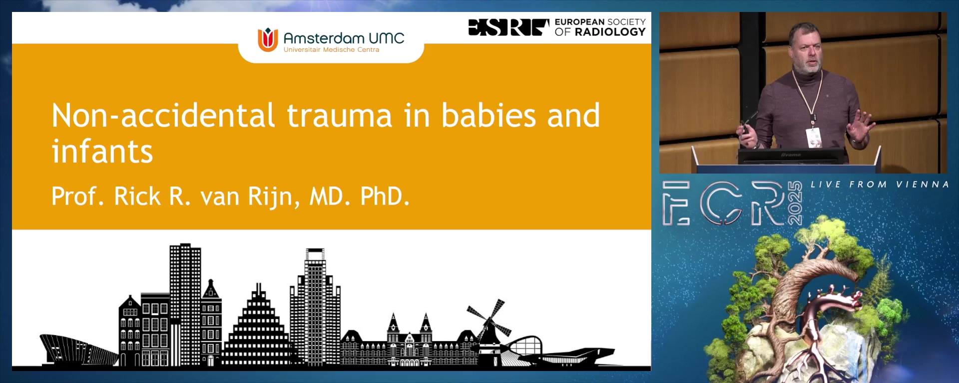 Non-accidental trauma in babies and infants