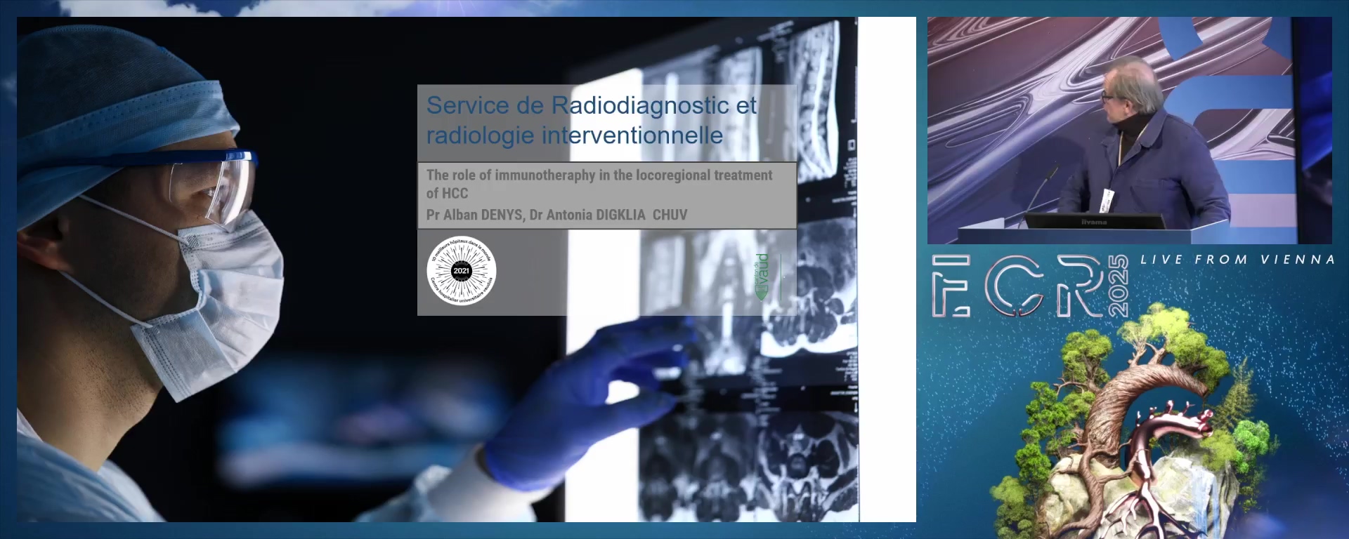 The role of immunotheraphy in the locoregional treatment of HCC