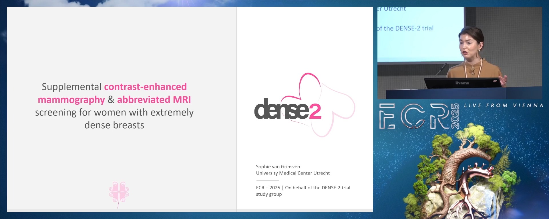 DENSE-2: supplemental contrast-enhanced mammography and abbreviated MRI screening for women with extremely dense breasts