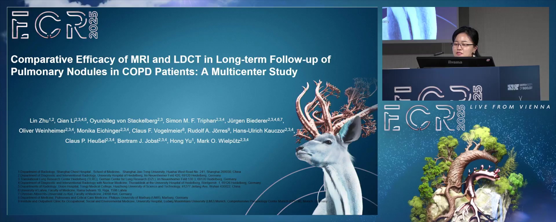 Comparative Efficacy of MRI and LDCT in Long-term Follow-up of Pulmonary Nodules in COPD Patients: A Multicenter Study