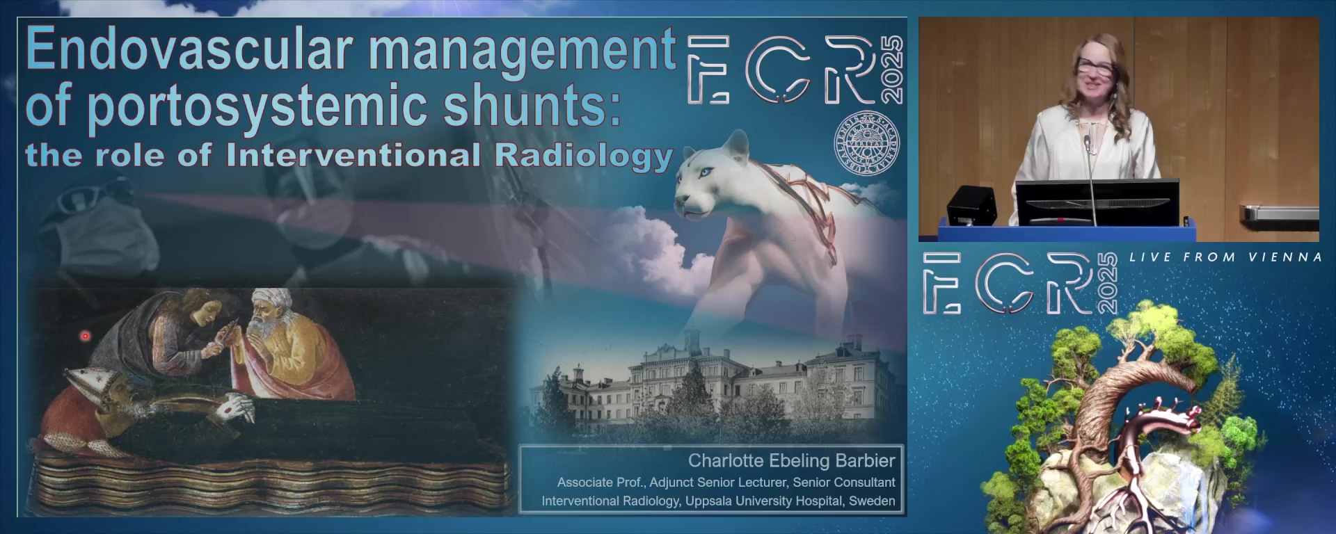 Endovascular management of portosystemic shunts: the role of interventional radiology
