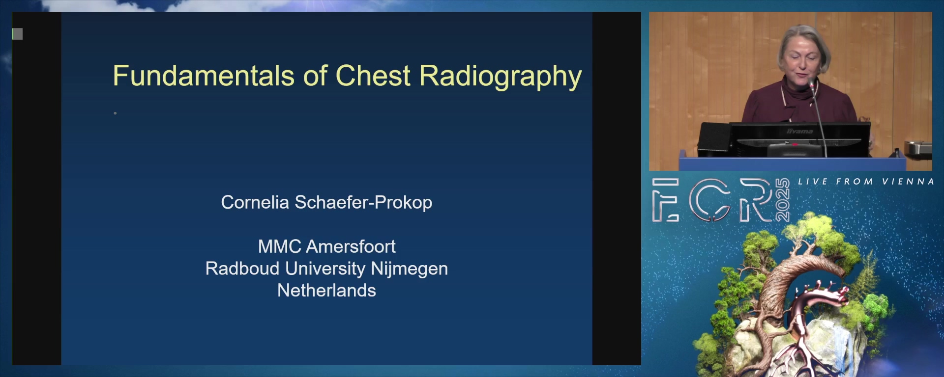 Fundamentals of chest radiography