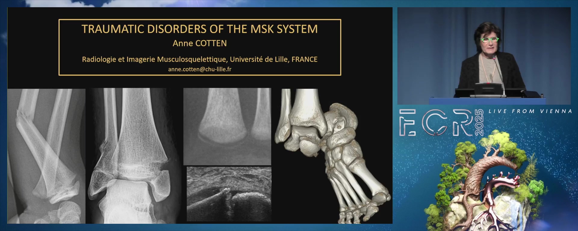 Traumatic disorders of the musculoskeletal system