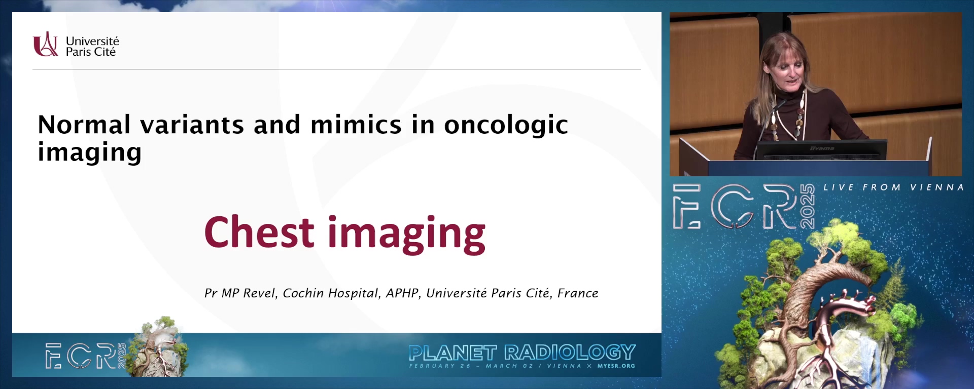 Chest imaging