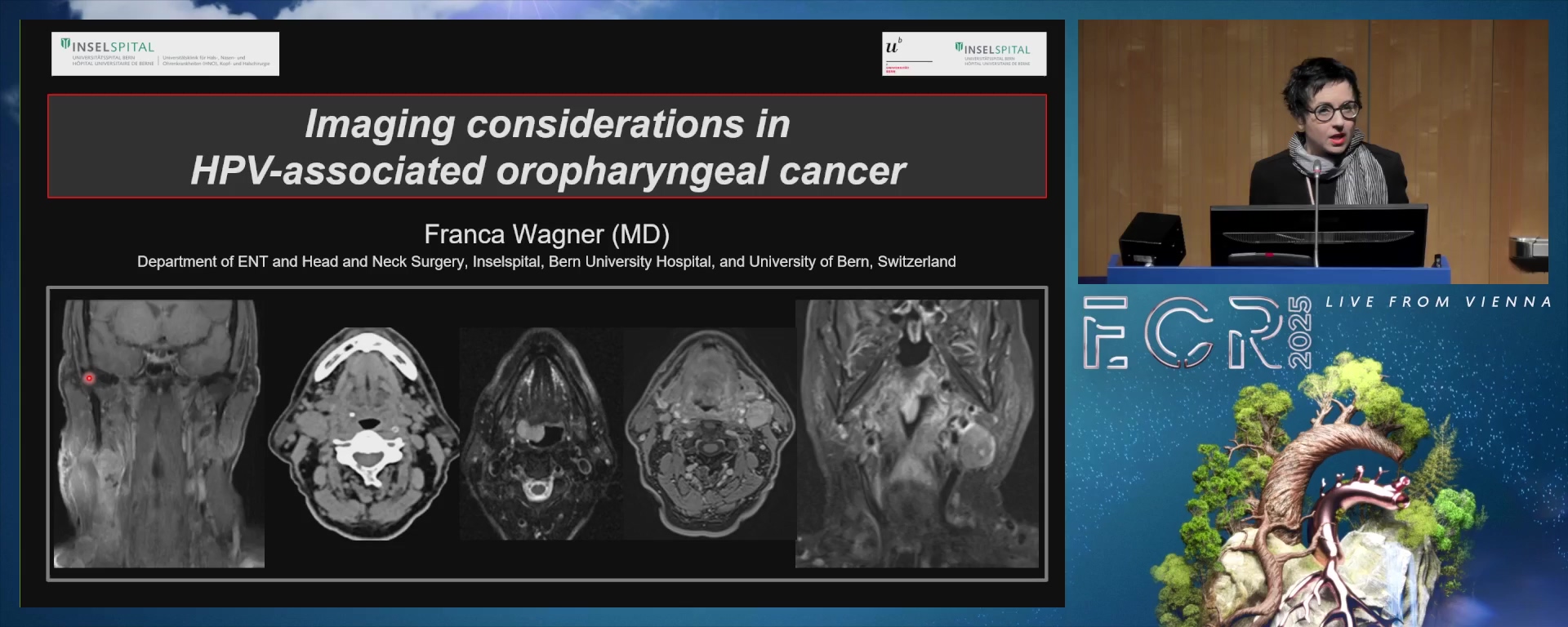 Imaging considerations in HPV-associated oropharyngeal cancer