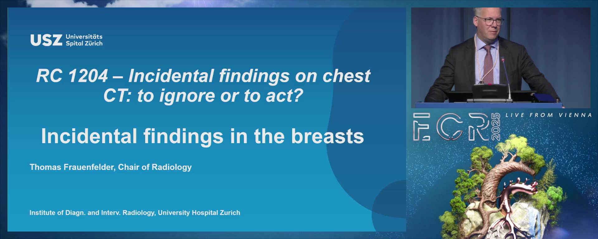 Incidental findings in the breasts