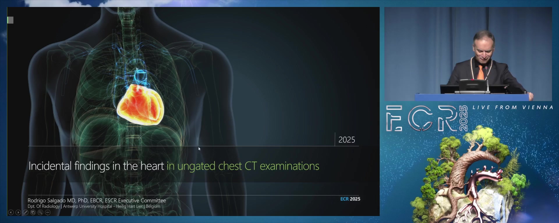 Incidental findings in the heart