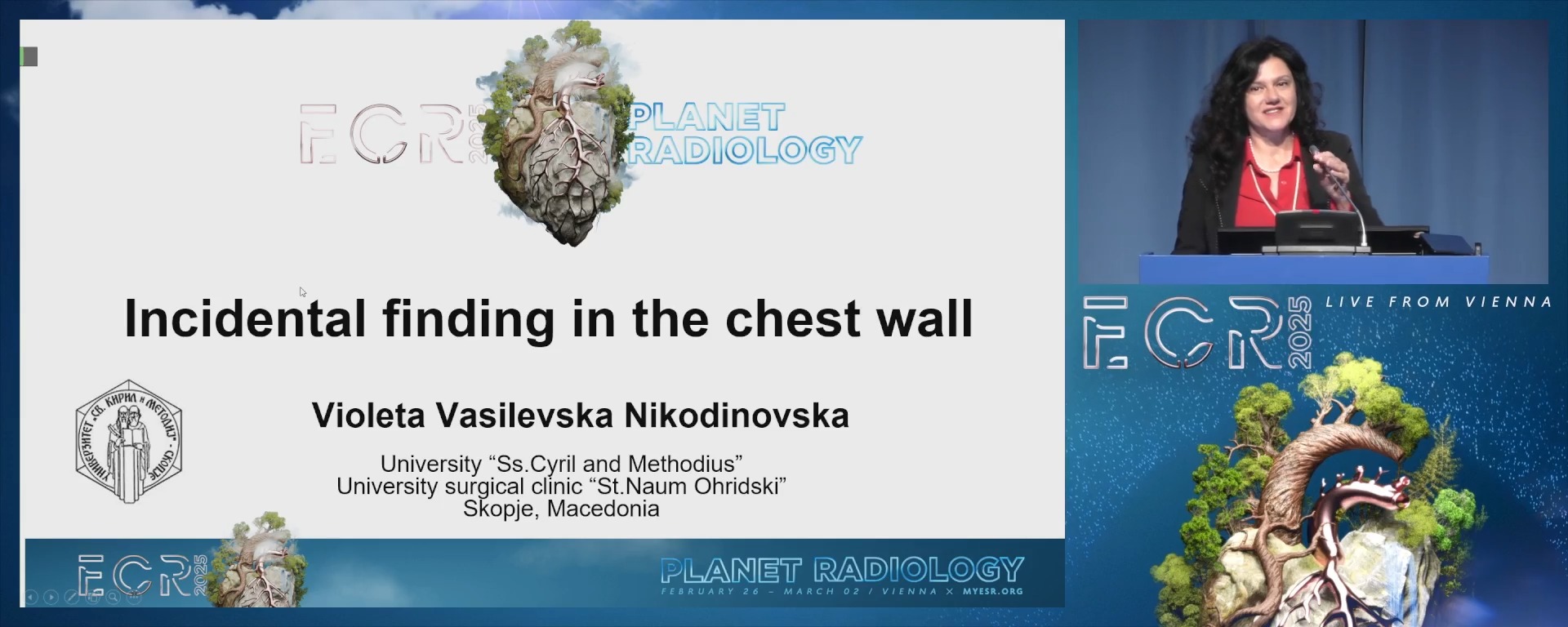 Incidental findings in the chest wall