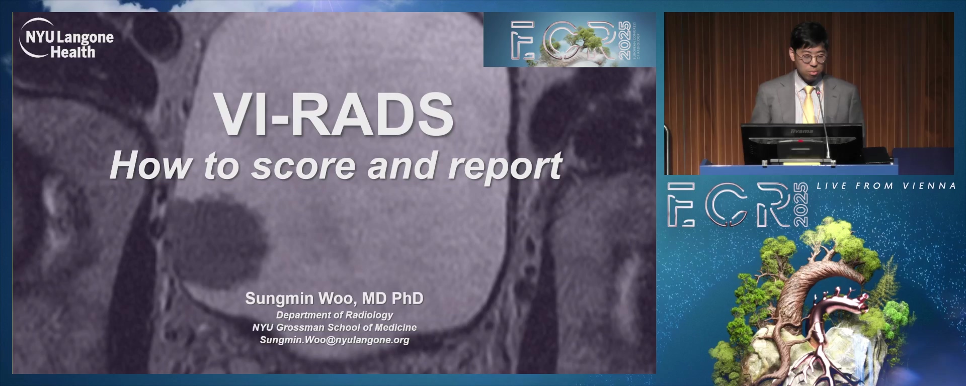 How to score and report bladder cancer with VI-RADS?
