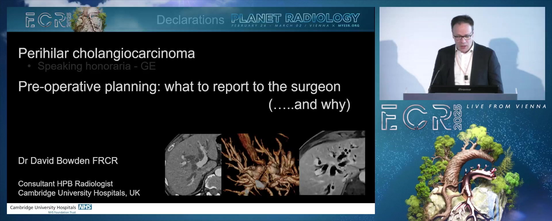 Preoperative planning: what to report to the surgeon