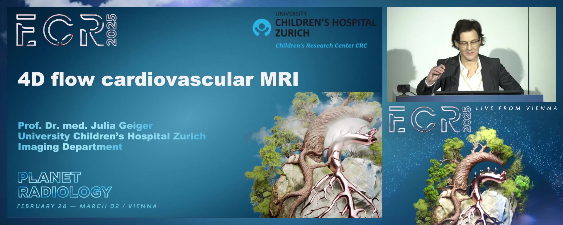 4D flow cardiovascular MRI