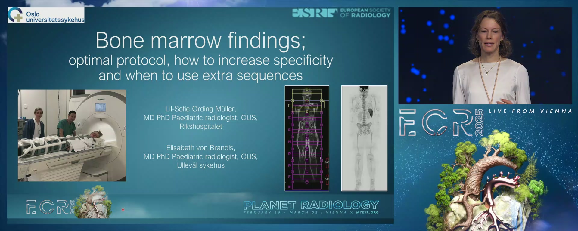 Optimal protocol: how to increase specificity and when to use extra sequences?