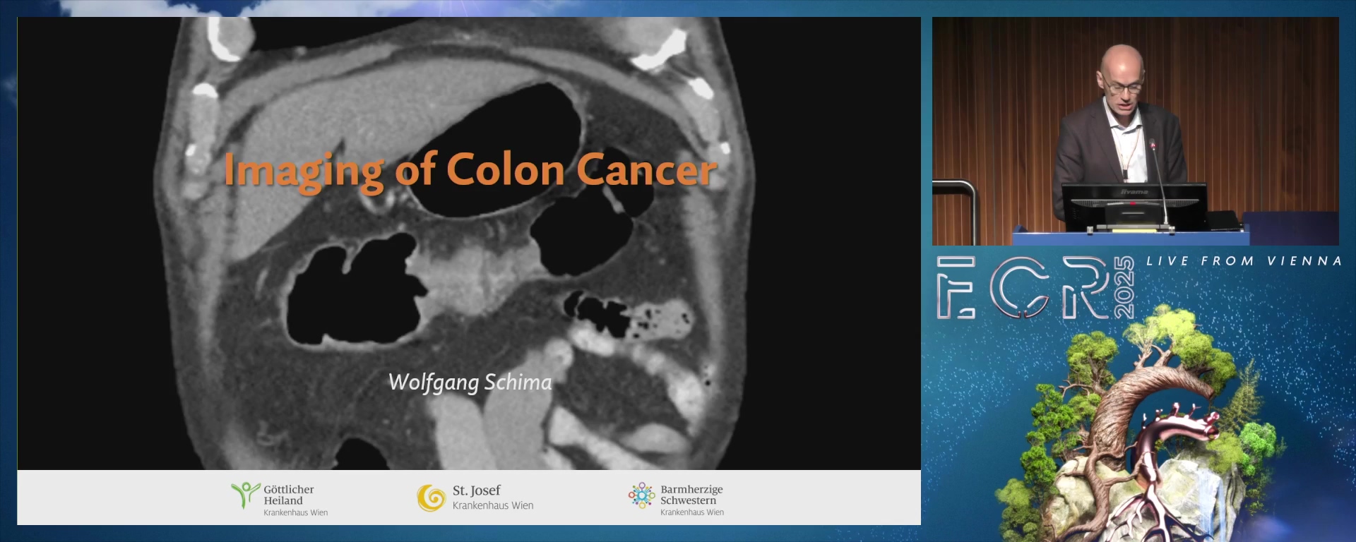 Imaging of colon cancer