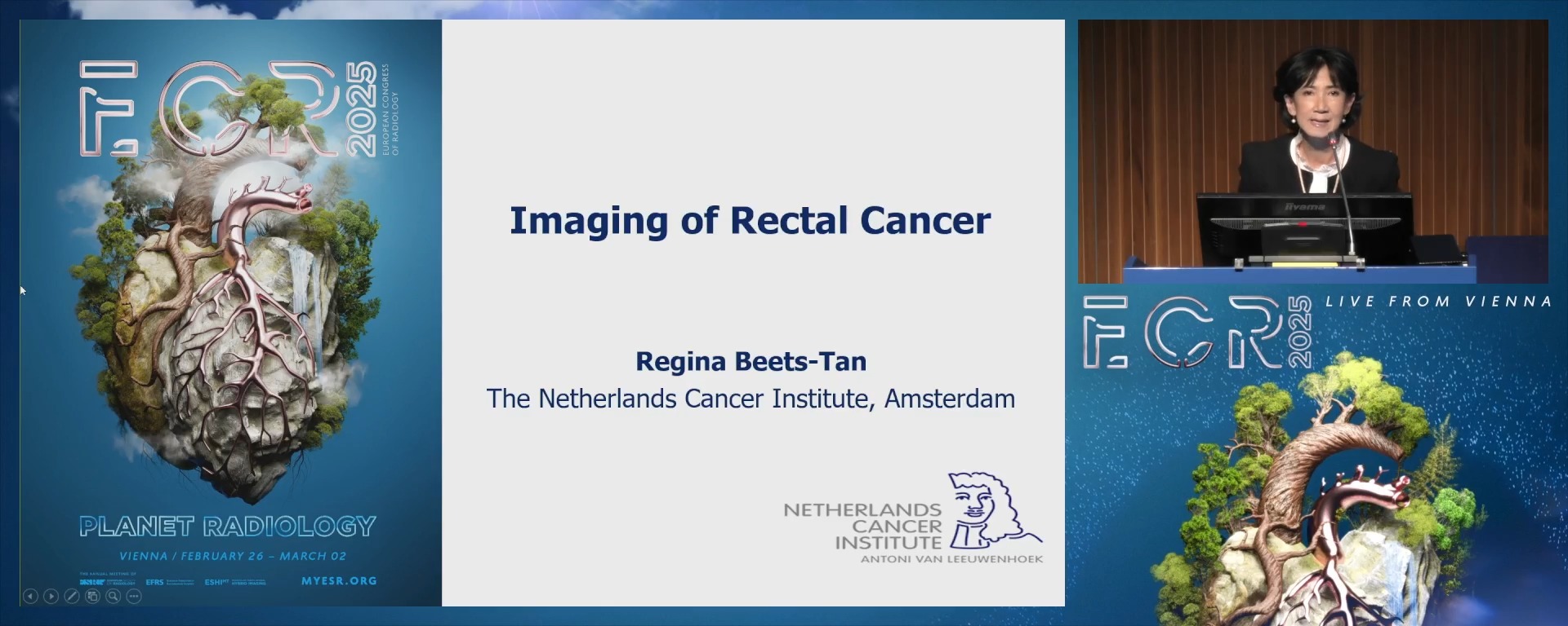 Imaging of rectal cancer