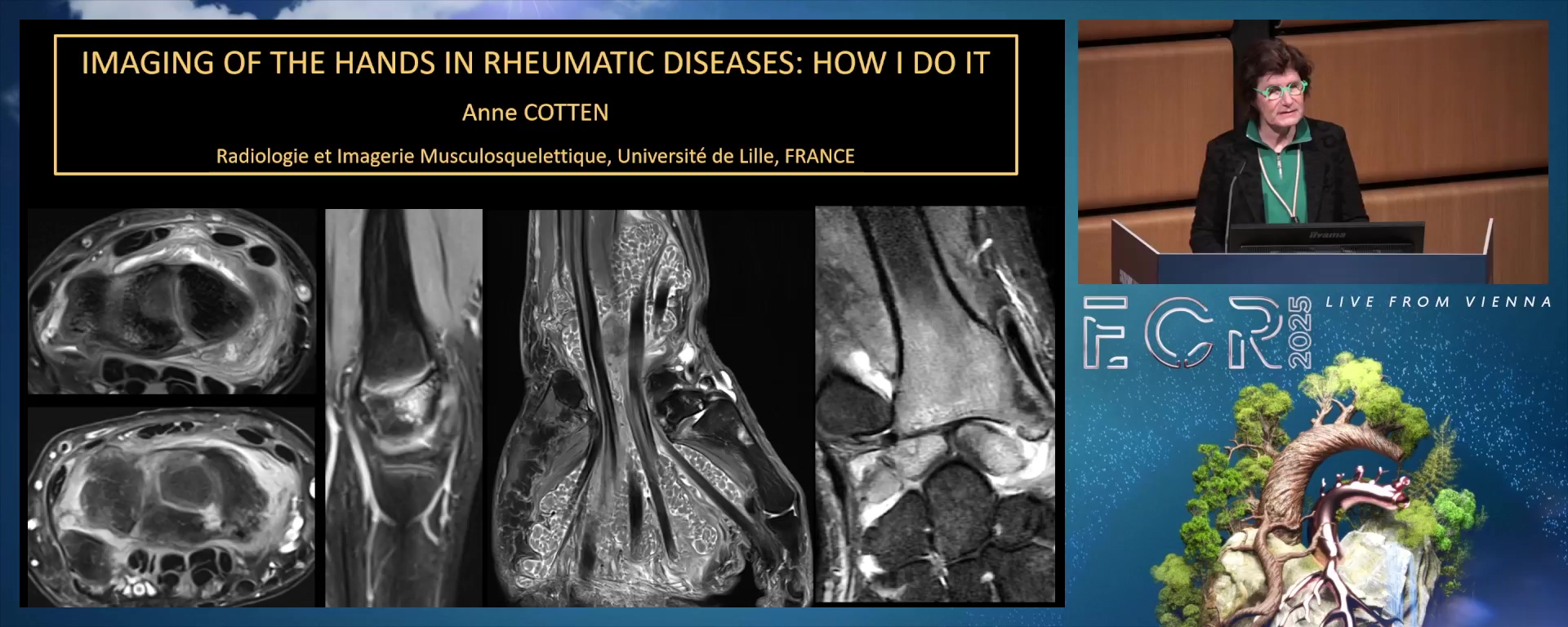 MR imaging of the hands in rheumatic diseases: how I do it