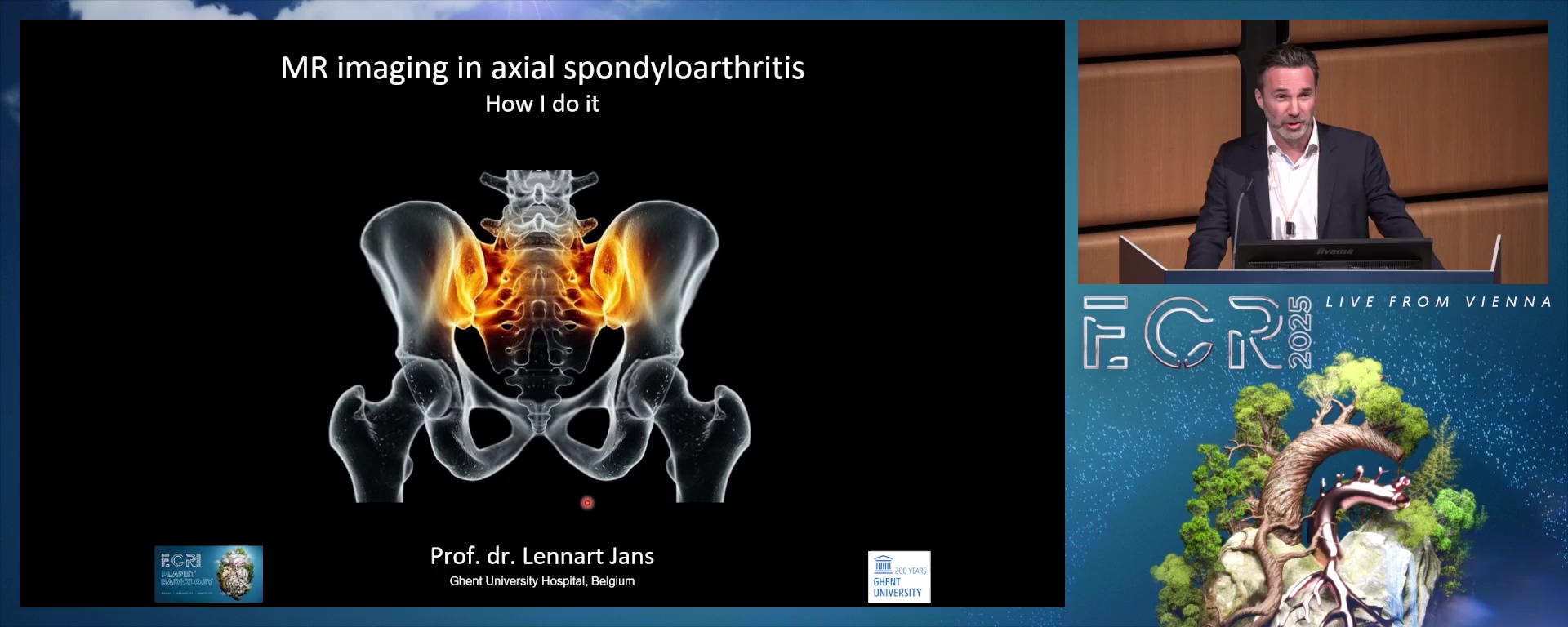 MR imaging in axial spondyloarthropathy: how I do it
